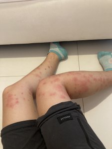 Les moustiques maltais